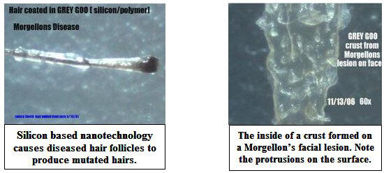 Morgellons nanotechnology exposed